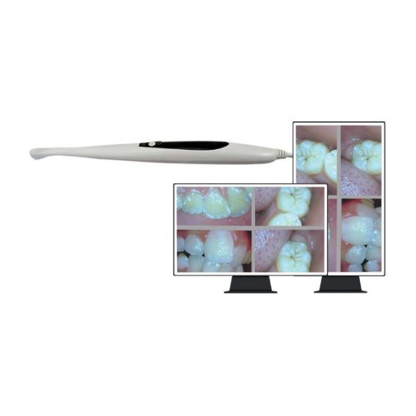 All-in-One PC Intraoral Camera