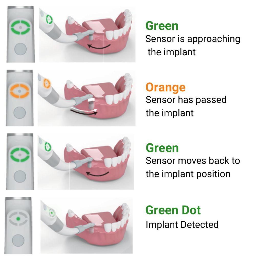 Yahope iD1 implant location detector Yahope iD1 implant location detector